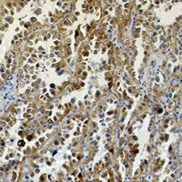 19 - Anti-Carbonic Anhydrase 9 Antibody Antibody AP61574