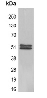 5 - Anti-Carbonic Anhydrase 9 Antibody Antibody AP61574
