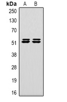 1 - Anti-Carbonic Anhydrase 9 Antibody Antibody AP61574