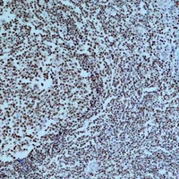 19 - Anti-Cleaved PARP1 Antibody AP61576