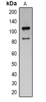 1 - Anti-Cleaved PARP1 Antibody AP61576