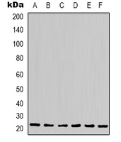 1 - Anti-Cyclophilin B Antibody AP61577