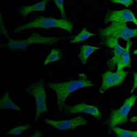 3 - Anti-eIF4AI Antibody AP61578
