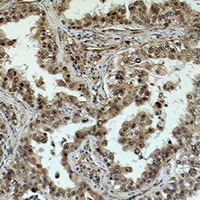 19 - Anti-eIF4AI Antibody AP61578