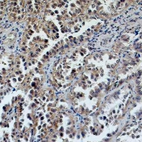 19 - Anti-ERCC1 Antibody AP61579