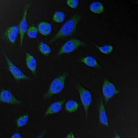 3 - Anti-Fumarase Antibody AP61580