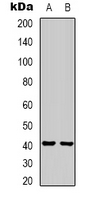 1 - Anti-HAO1 Antibody AP61582