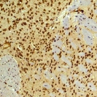 19 - Anti-HIF1 beta Antibody AP61583