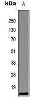 1 - Anti-Histone H3 (DiMethyl-K27) Antibody AP61584