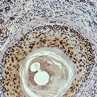 19 - Anti-Histone H3 (DiMethyl-K9) Antibody AP61586