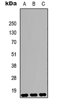1 - Anti-Histone H3 (DiMethyl-K9) Antibody AP61586