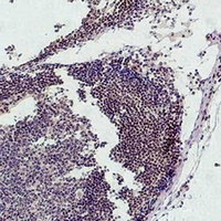19 - Anti-Histone H3 (MonoMethyl-K9) Antibody AP61587