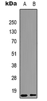 1 - Anti-Histone H3 (MonoMethyl-K9) Antibody AP61587