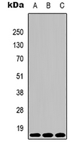 1 - Anti-Histone H3 (TriMethyl-K4) Antibody AP61589