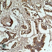 19 - Anti-HSP27 Antibody AP61590