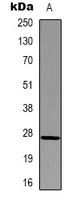 1 - Anti-HSP27 Antibody AP61590