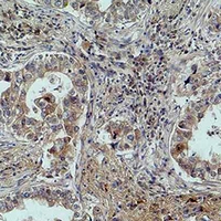 19 - Anti-MICU1 Antibody AP61592
