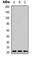 1 - Anti-Peroxiredoxin 1 Antibody AP61594