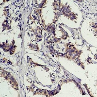 19 - Anti-Phosphotyrosine Antibody AP61596