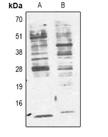 1 - Anti-Phosphotyrosine Antibody AP61596