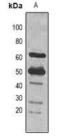 1 - Anti-Rubisco Large Chain Antibody AP61597