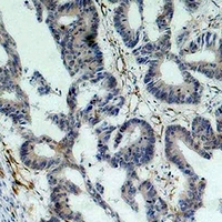 19 - Anti-Survivin Antibody AP61598