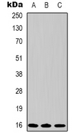 1 - Anti-Survivin Antibody AP61598