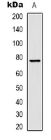1 - Anti-Transferrin Antibody AP61600