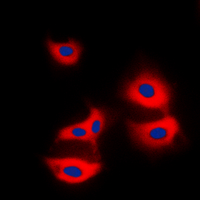 3 - Anti-LC3B Antibody AP61601