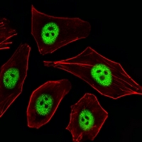 3 - Anti-p21 Antibody AP61602