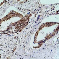 19 - Anti-p21 Antibody AP61602