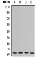 1 - Anti-p21 Antibody AP61602