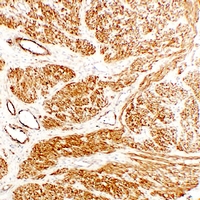 0 - Anti-Caldesmon Antibody AP61604