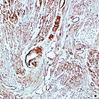 0 - Anti-Caldesmon Antibody AP61604