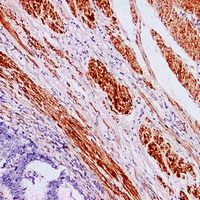 0 - Anti-Caldesmon Antibody AP61604