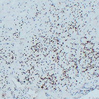 0 - Anti-MYOD1 Antibody AP61612