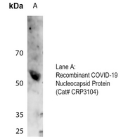 1 - Anti-COVID-19 Nucleocapsid Protein Antibody AP61625