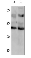 1 - Anti-Frataxin Antibody AP61627