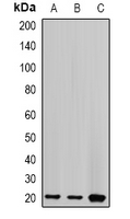 1 - Anti-Centrin-2 Antibody AP61628