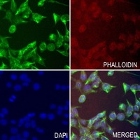3 - Anti-HSD17B13 Antibody AP61630