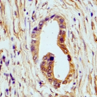19 - Anti-HSD17B13 Antibody AP61630