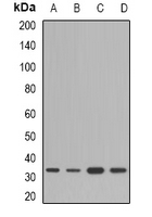 1 - Anti-HSD17B13 Antibody AP61630