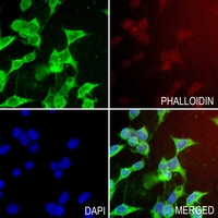 3 - Anti-C4BP beta Antibody AP61631