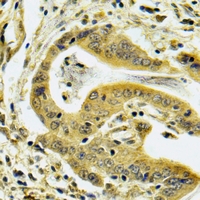 19 - Anti-C4BP beta Antibody AP61631