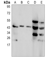 1 - Anti-C4BP beta Antibody AP61631