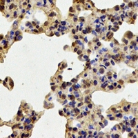19 - Anti-TPP2 Antibody AP61632