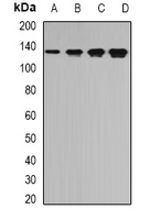 1 - Anti-TPP2 Antibody AP61632