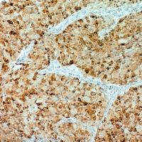 19 - Anti-p62 Antibody AP61633