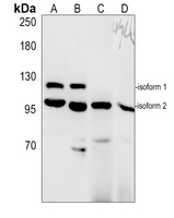 1 - Anti-SIRT1 Antibody AP61635