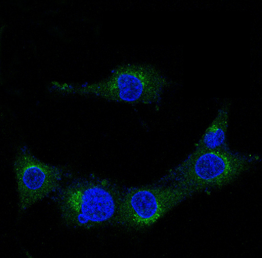 2 - Amyloid beta A4 Antibody  AP90292